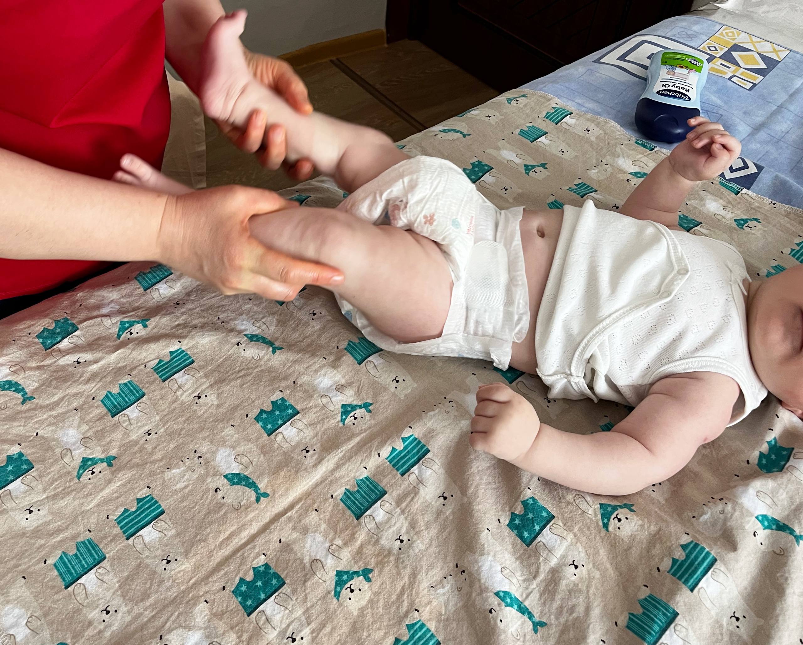 ЛФК при дисплазии тазобедренных суставов